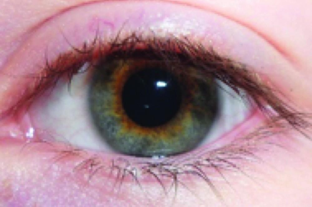 Drivers Urged to get Regular Eye Tests Drivers Urged to get Regular Eye Tests